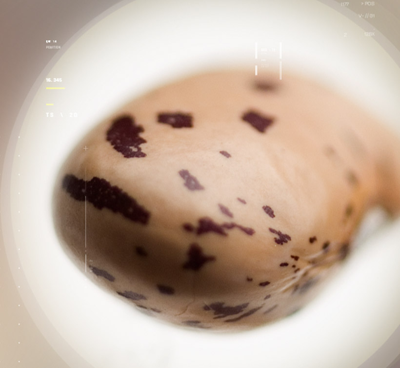 Beanblock<sup>®</sup>