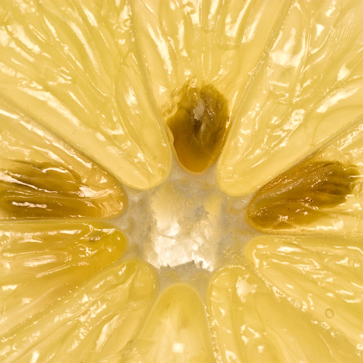 Vazguard<sup>®</sup> into action