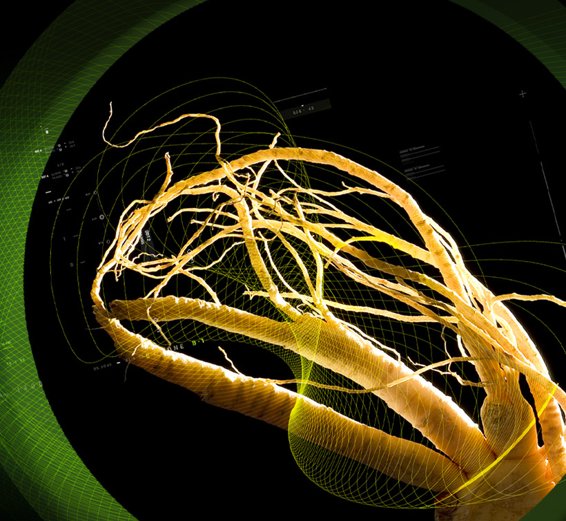 Ginselect<sup>®</sup>